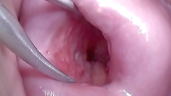Japanese Wife Open Cervix Wide to watch inside Uterus