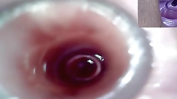 Lesbians Extreme Cervix Play and Peehole Fucking Penis Dildo